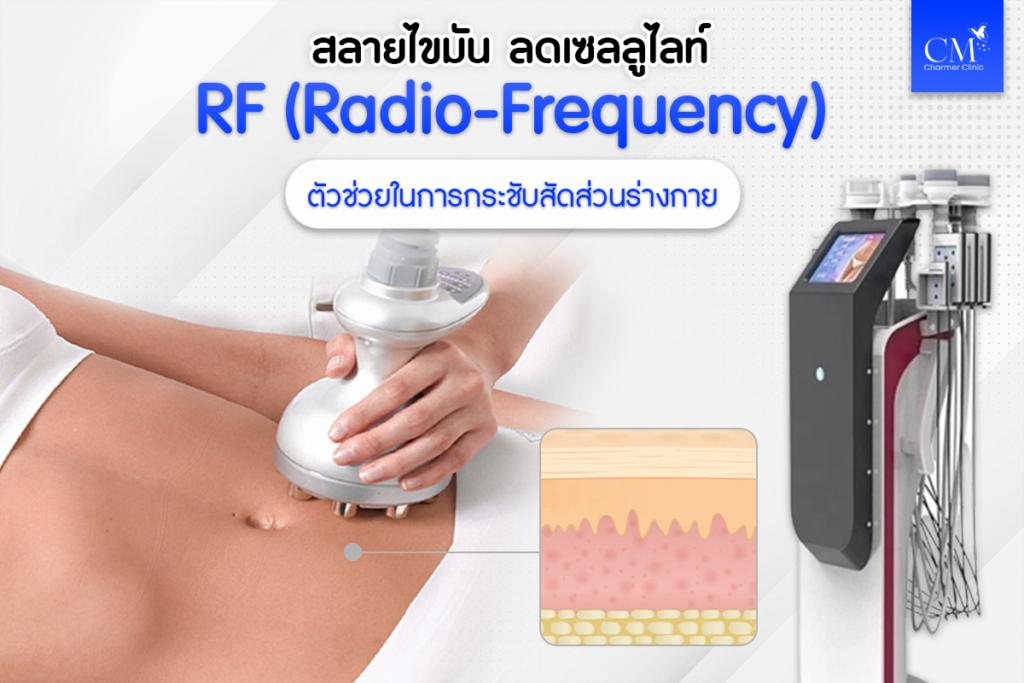 สลายไขมัน, ลดเซลลูไลท์, RF (Radio-Frequency)
