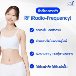 ข้อดีของการทำ RF (Radio-Frequency) 