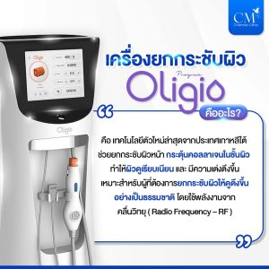 Oligio เครื่องยกกระชับผิว
