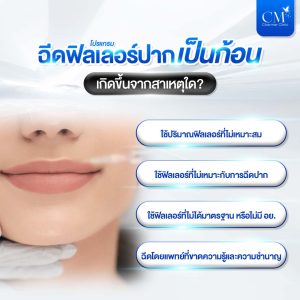 ฉีดฟิลเลอร์ปากเป็นก้อน เกิดขึ้นจากสาเหตุใด