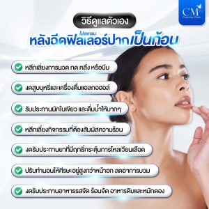 ดูแลตัวเอง หลังฉีดฟิลเลอร์ปากเป็นก้อน 