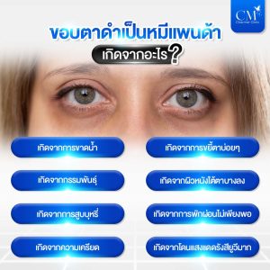ขอบตาดำ สาเหตุเกิดจากอะไร