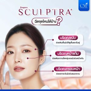 ฉีด Sculptra จุดไหน