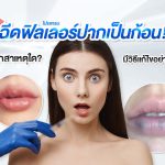 ฉีดฟิลเลอร์ปากเป็นก้อน