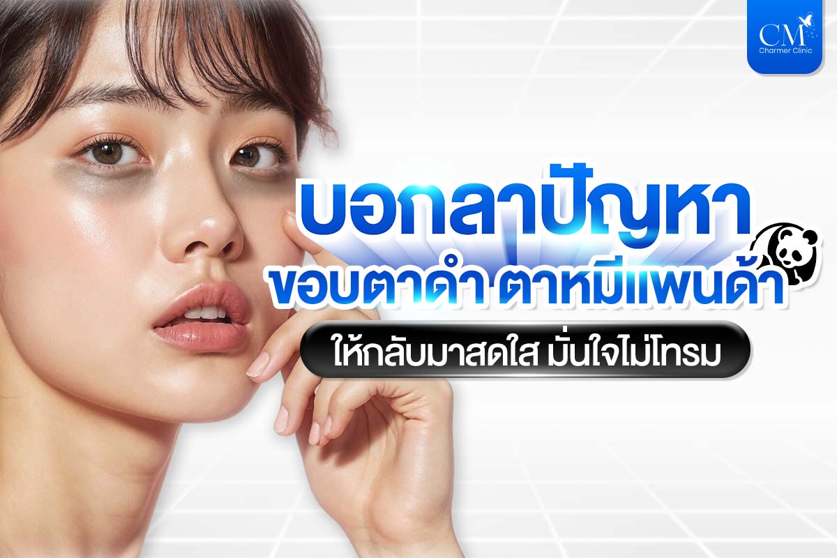 ขอบตาดำ ตาหมีแพนด้า แก้ยังไง