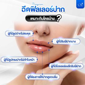 ฉีดฟิลเลอร์ปาก เหมาะกับใคร