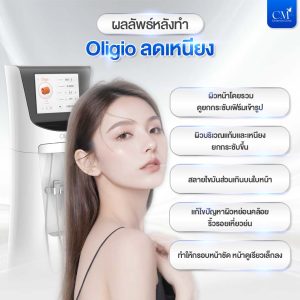 ผลลัพธ์หลังทำ Oligio