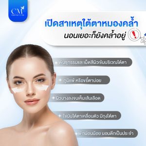 สาเหตุ ใต้ตาหมองคล้ำ