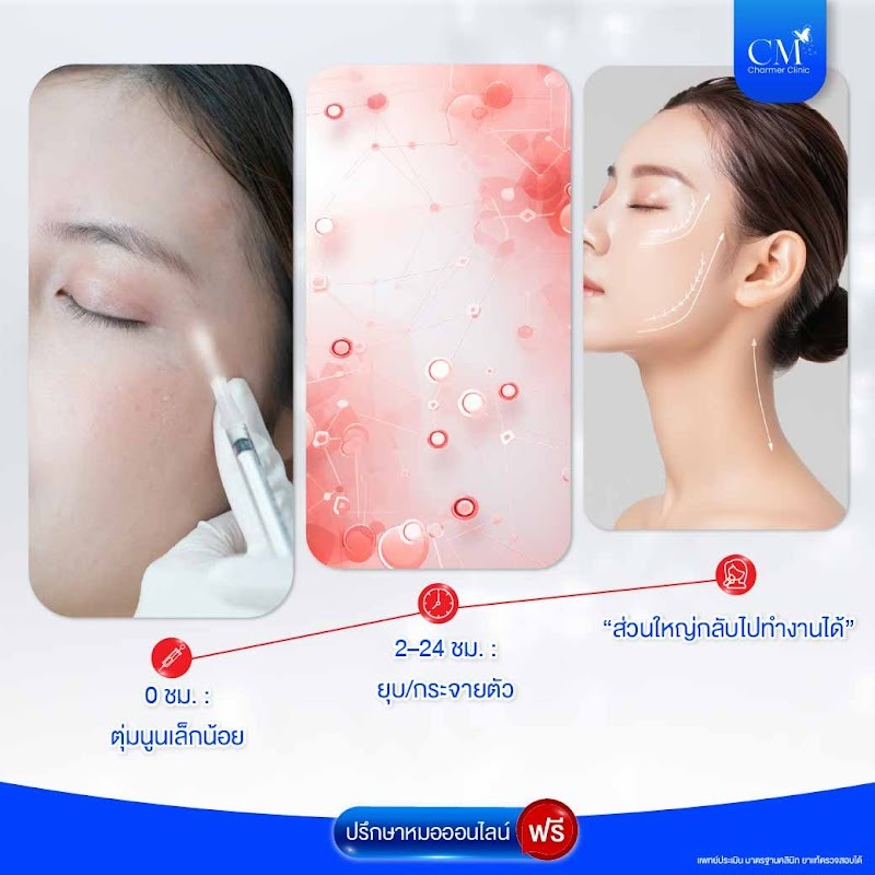 Ejal 40 Downtime บวมกี่วัน