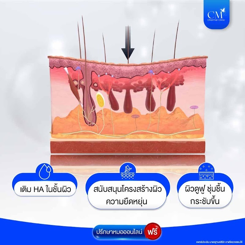 หลักการทำงานของ Ejal 40
